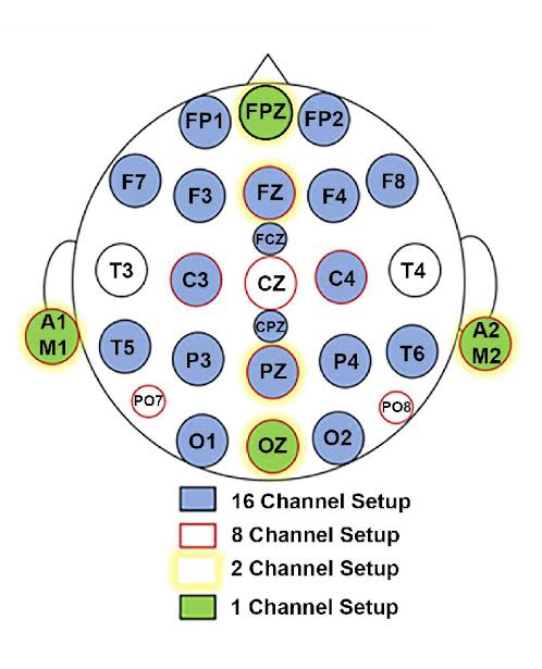 Electrode Placement